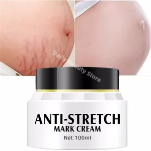 Stretch Mark Cream Postpartum Repair